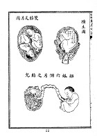 增補繪圖胎產心法（醫054）試閱-22